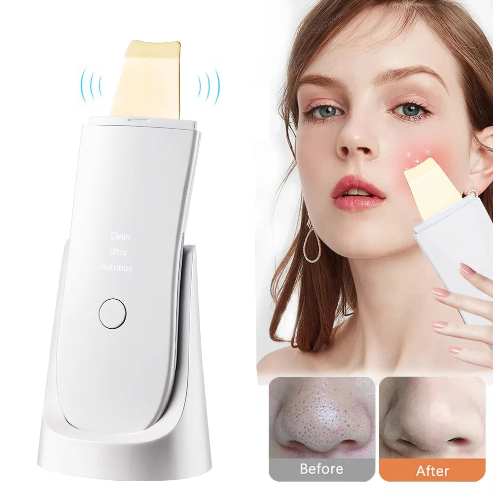 Limpiador Facial Electric Blackhead Remover Exfoliator Moisturizing Facial Cleaner Nano Spray Technology Metal Scraper Tool