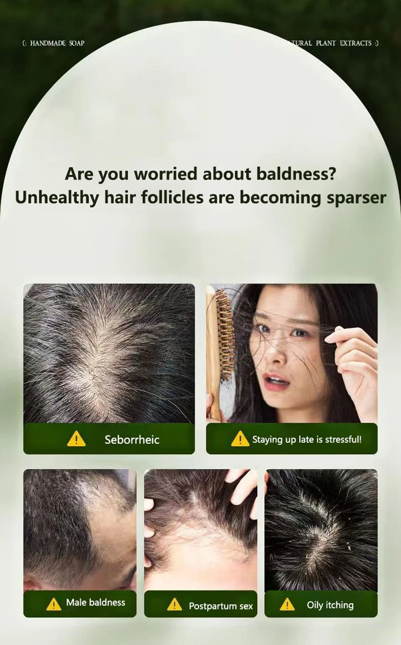 120g Seven-green Usman Orchidaceae Shampoo Refreshing Cleansing Oil Control Anti-Itch Replenishing Soap Soft Handmade Soap