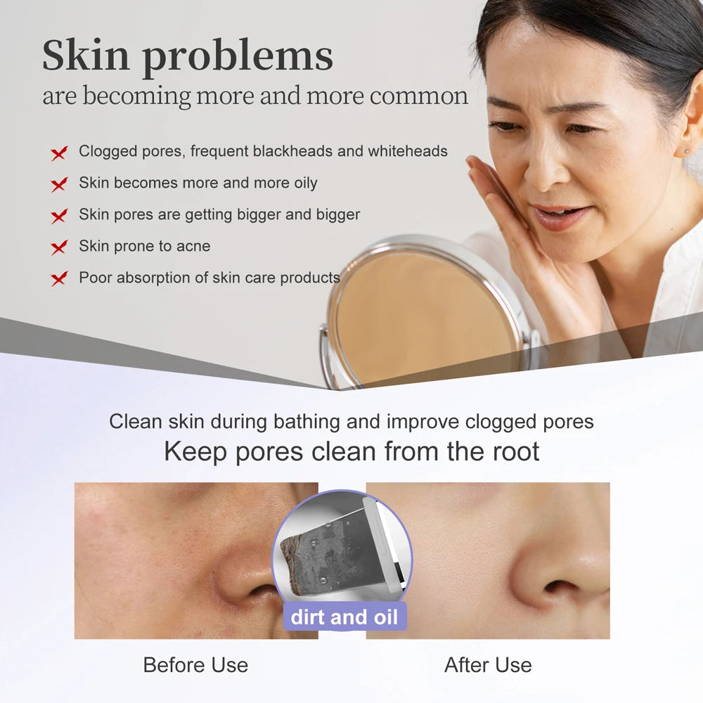ANLAN Ultrasonic Skin Scrubber Peeling Facial Ultrasonic EMS Facial Lifting Red Blue Skin Care Pore Deep Cleansing Machine IPX7