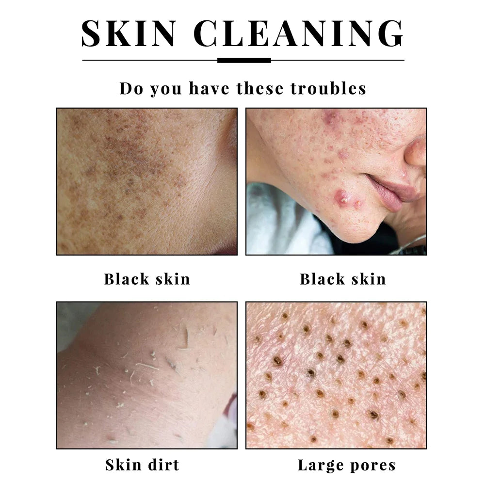 Handmade Kojic Acid Soap Natural Mild Non-irritating Brightening Skin Exfoliator Body Face Cleansing Whitening Soap