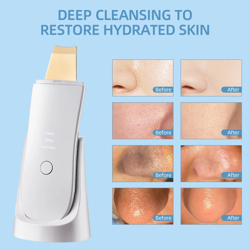 Limpiador Facial Electric Blackhead Remover Exfoliator Moisturizing Facial Cleaner Nano Spray Technology Metal Scraper Tool