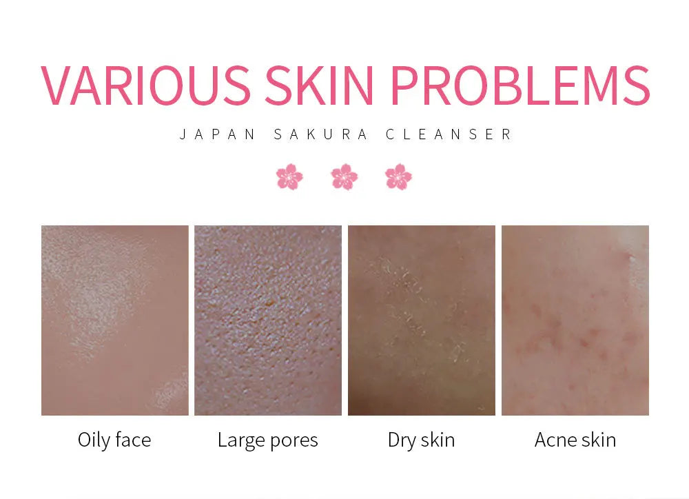 Laikou Sakura Whitening Facial Cleanser Foam Moisturizing Deep Remove Cleansing Acne Milk Oil Control Exfoliating Shrink Pores