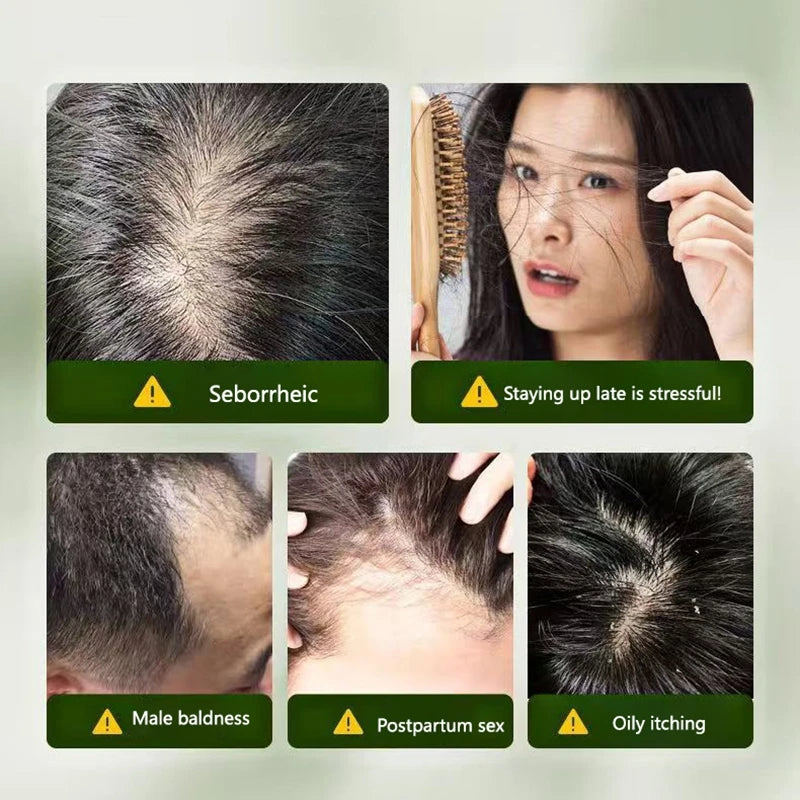 120g Seven-green Usman Orchidaceae Shampoo Refreshing Cleansing Oil Control Anti-Itch Replenishing Soap Soft Handmade Soap