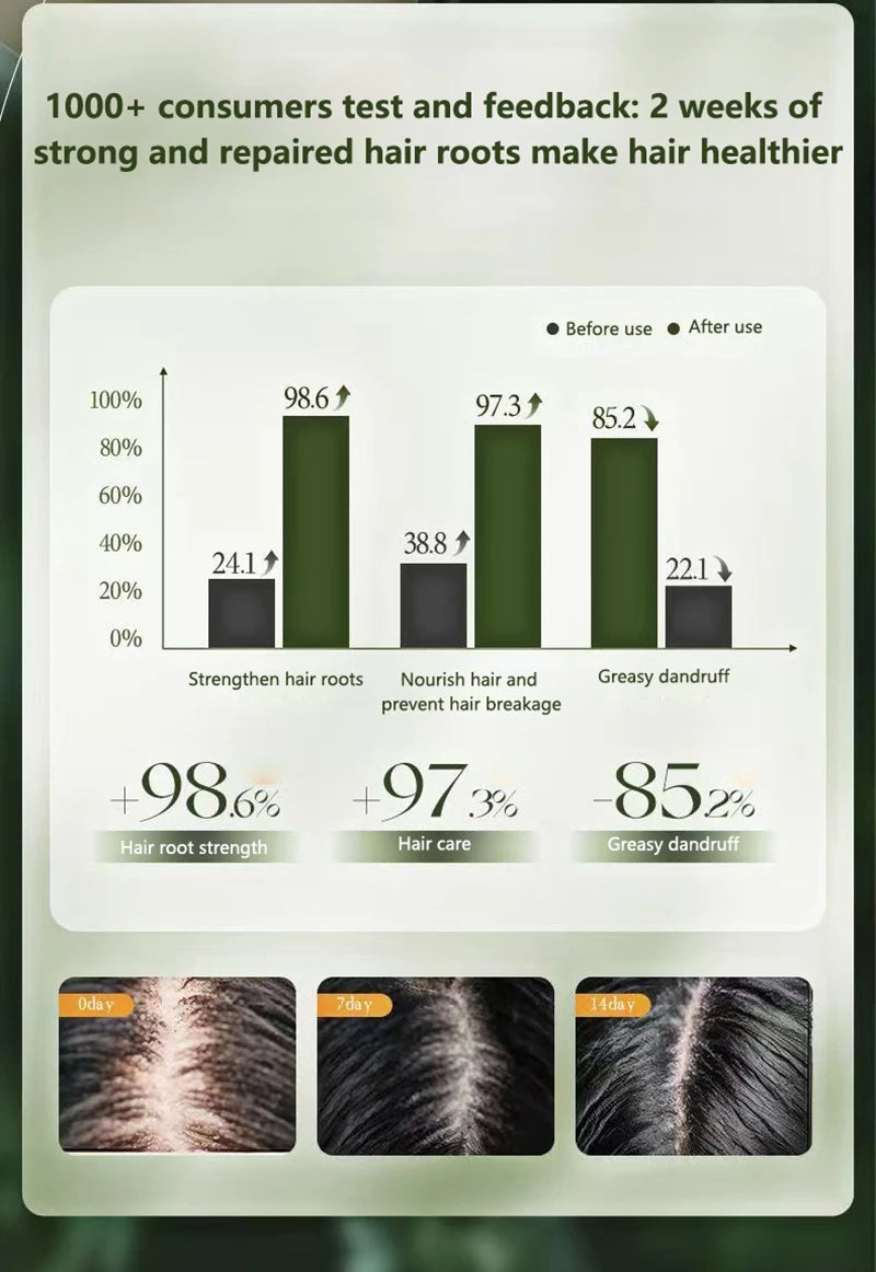 120g Seven-green Usman Orchidaceae Shampoo Refreshing Cleansing Oil Control Anti-Itch Replenishing Soap Soft Handmade Soap