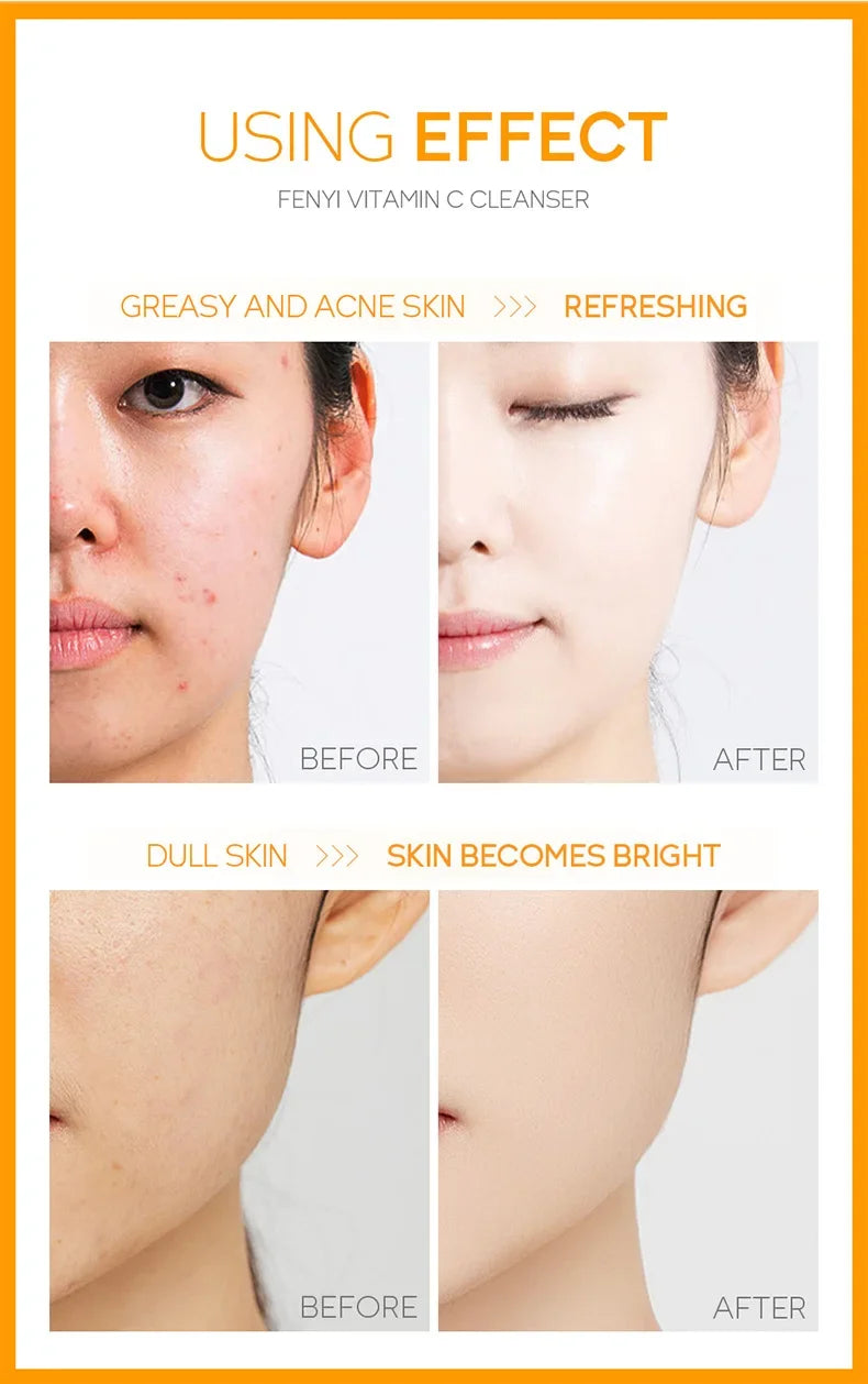 Japanese Cherry Blossom or Vitamin C Facial Cleanser Skin Cleansing Moisturizing  Blackhead Remove Skincare Face Wash Foam Face