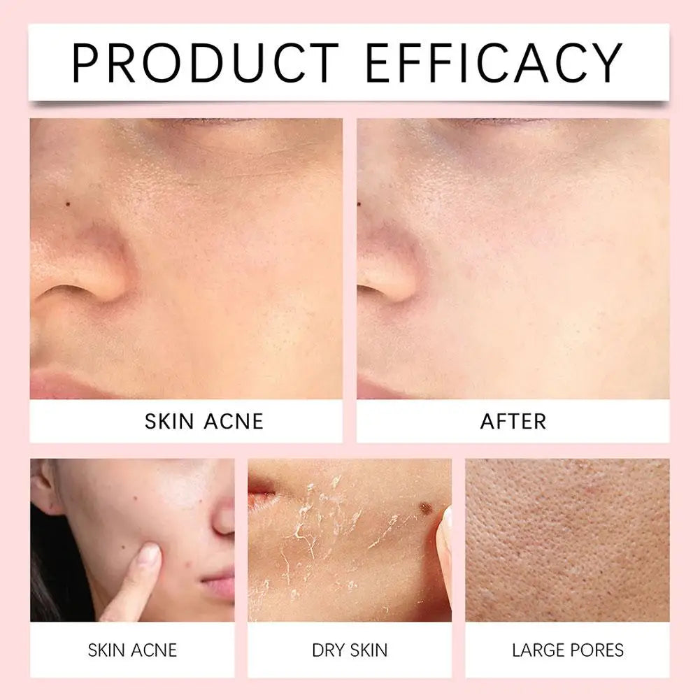 SKIN1004 Madagascar Centella Poremizing Deep Cleansing Foam Tone Brightening Cleansing Gel Foam Facial Moisturizing Cleanser