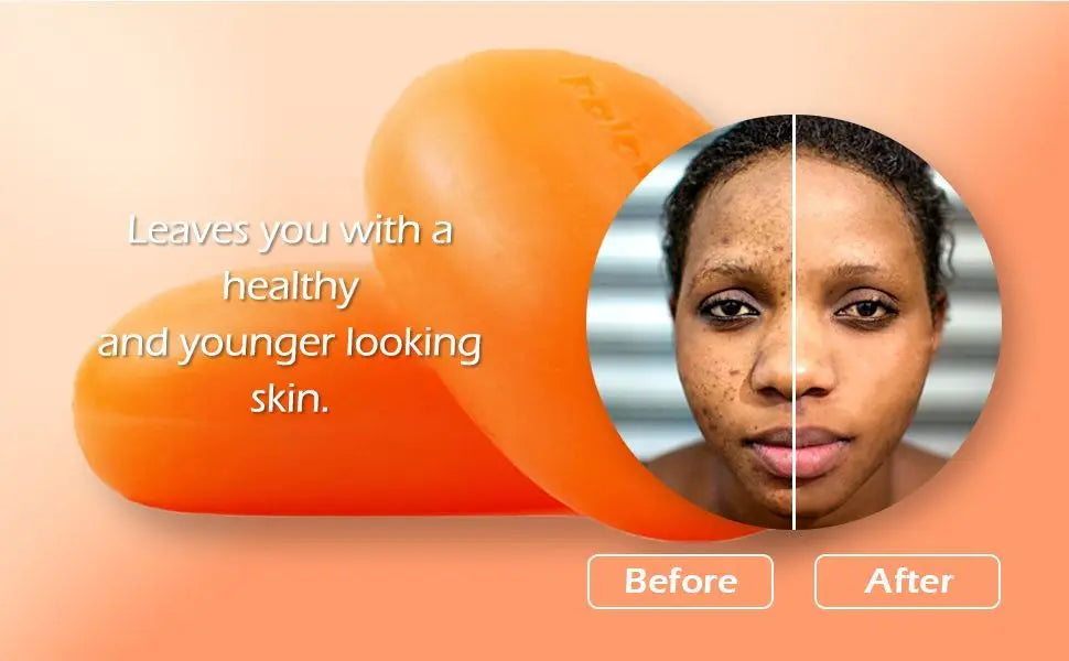 Kojic Acid Ginger Turmeric Handmade Soap for Cleansing and Whitening Fresh and Non Greasy for Bath Skin Care for Home Use