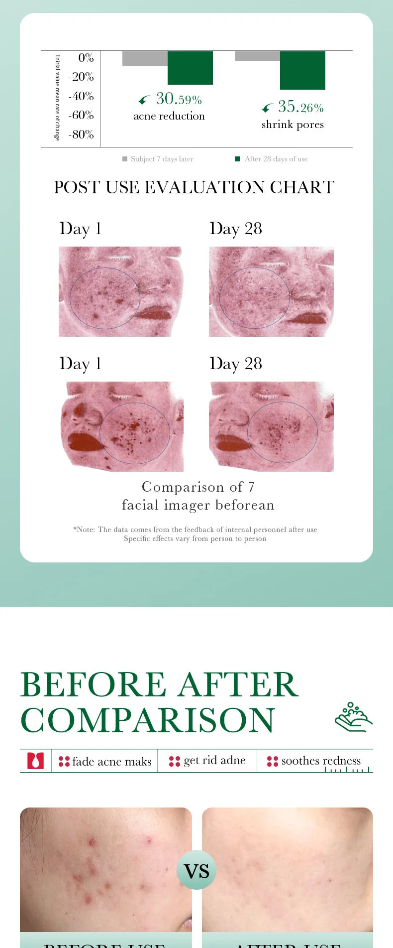 BIOAOUA Salicylic Acid Facial Cleanser Acne Treatment Moisturizing Oil Control skincare Face Wash Foam Face Cleanser Skin Care