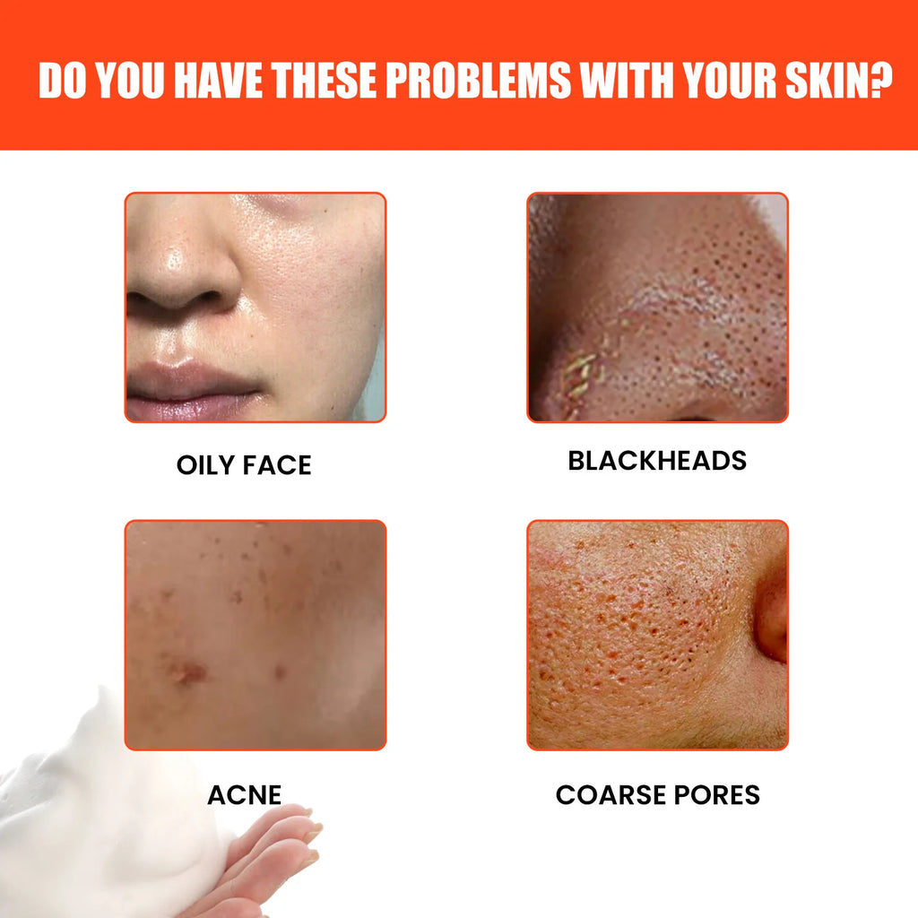 Men Face Wash Oil Control Shrink Pores Acne Blackhead Removal Deep Cleansing Moisturizing Exfoliating Whitening Face Cleanser
