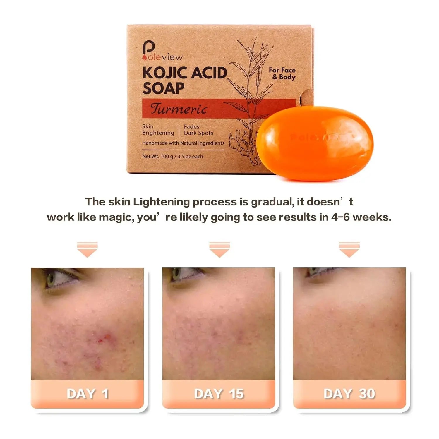 Kojic Acid Ginger Turmeric Handmade Soap for Cleansing and Whitening Fresh and Non Greasy for Bath Skin Care for Home Use