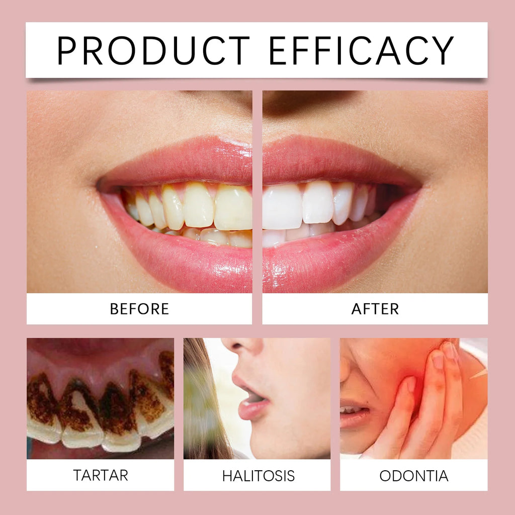 Coconut Pulling Oil Mouthwash Oral Rinse Alcohol-free Herbal Teeth Whitening Fresh Oral Remove Tooth Yellow Stains Odor OralCare