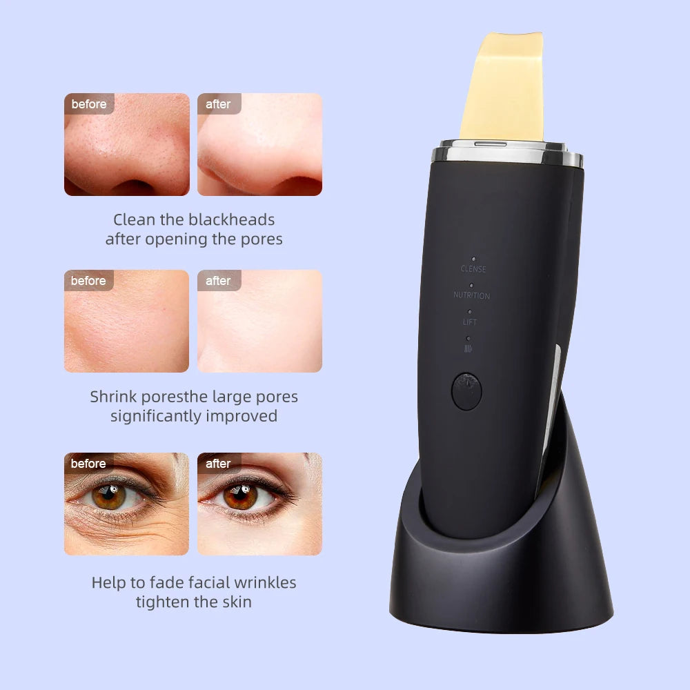 New Ultrasonic Skin Scrubber Vibration Face Spatula Blackhead Remover Shovel Clean Cavitation Peeling Facial Lifting EMS Machine