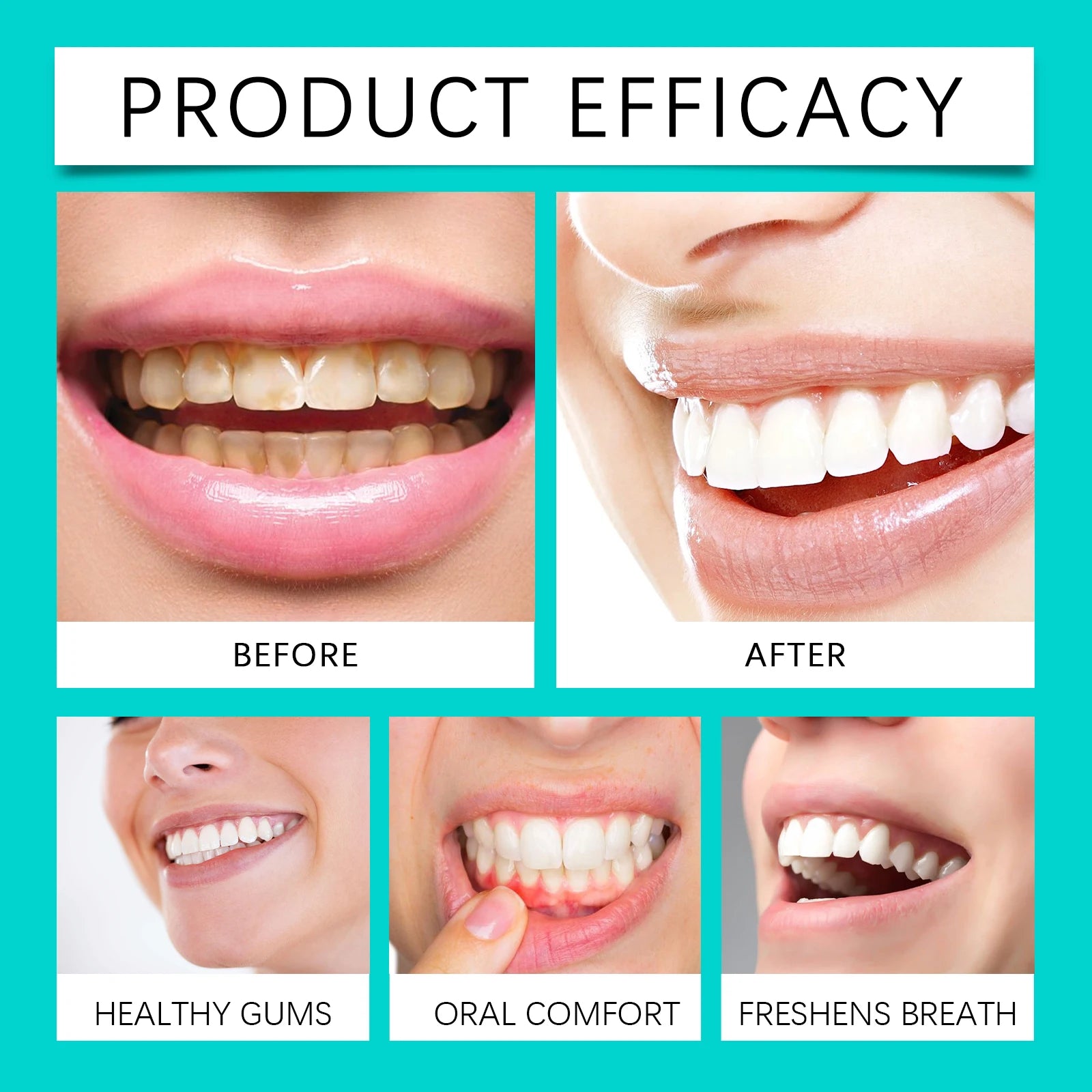 Oralhoe Coconut Mint Pulling Oil Mouthwash Removes Tooth Stains Yellow Teeth Prevents Bad Breath Freshens Breath With Mouthwash