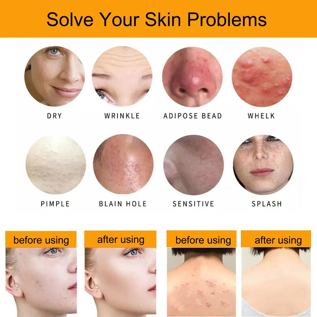 1/2/4/6Pcs Handmade Oat Soap,Natural,Gentle,Non Irritating, Brightening, Exfoliating, Body And Facial Cleansing, Whitening Soap