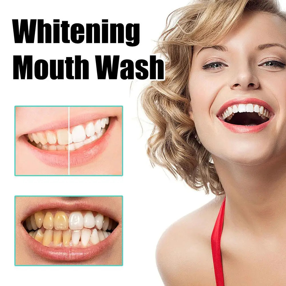 NEW Coconut Mint Pulling Oil Mouthwash Alcohol-free Teeth Whitening Fresh Oral Breath Oral Jelly Whitening Teeth Set