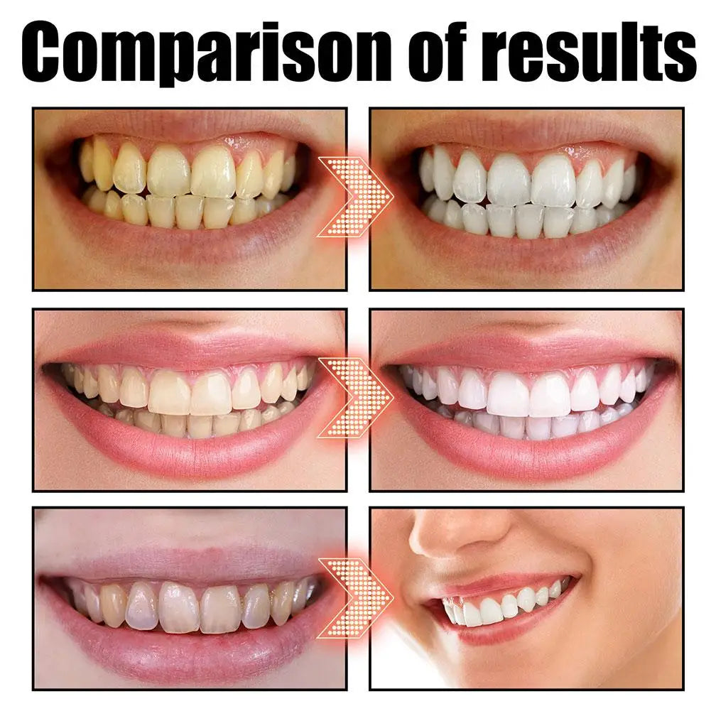 NEW Coconut Mint Pulling Oil Mouthwash Alcohol-free Teeth Whitening Fresh Oral Breath Oral Jelly Whitening Teeth Set