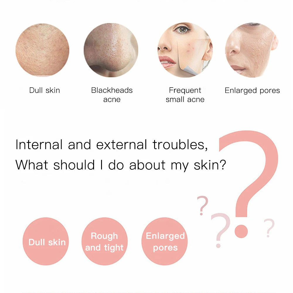 Electric Ultrasonic Skin Scrubber Vibration Face Spatula Peeling Blackhead Remover Facial Lifting Cleansing Ultrasonic Skin Care