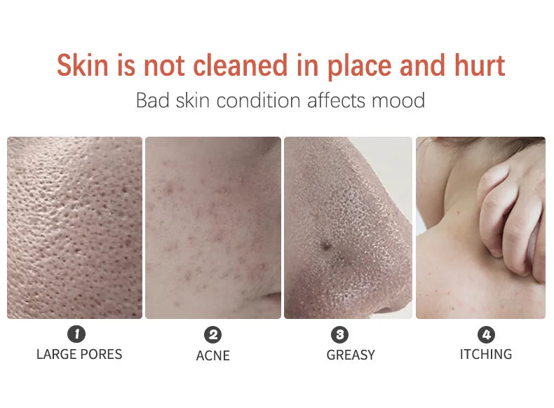 Turmeric Soap 110g Oil Control Handmade Soap for Face Body Cleansing with Essential Oil