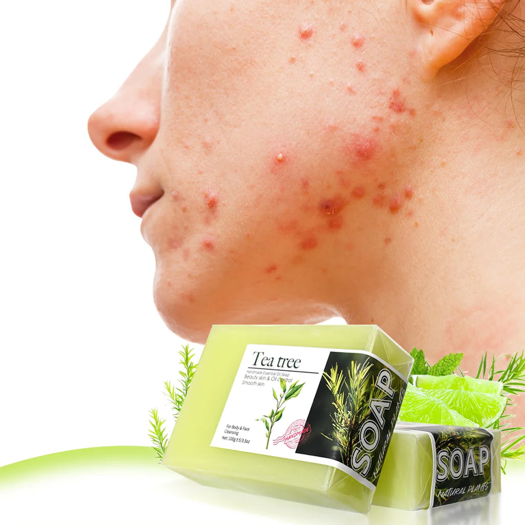 100g Tea Tree Essential Oil Soap Handmade Olive Oil Soap Plant Essential Oils Whitening Basic Cleaning Features Chemical Free