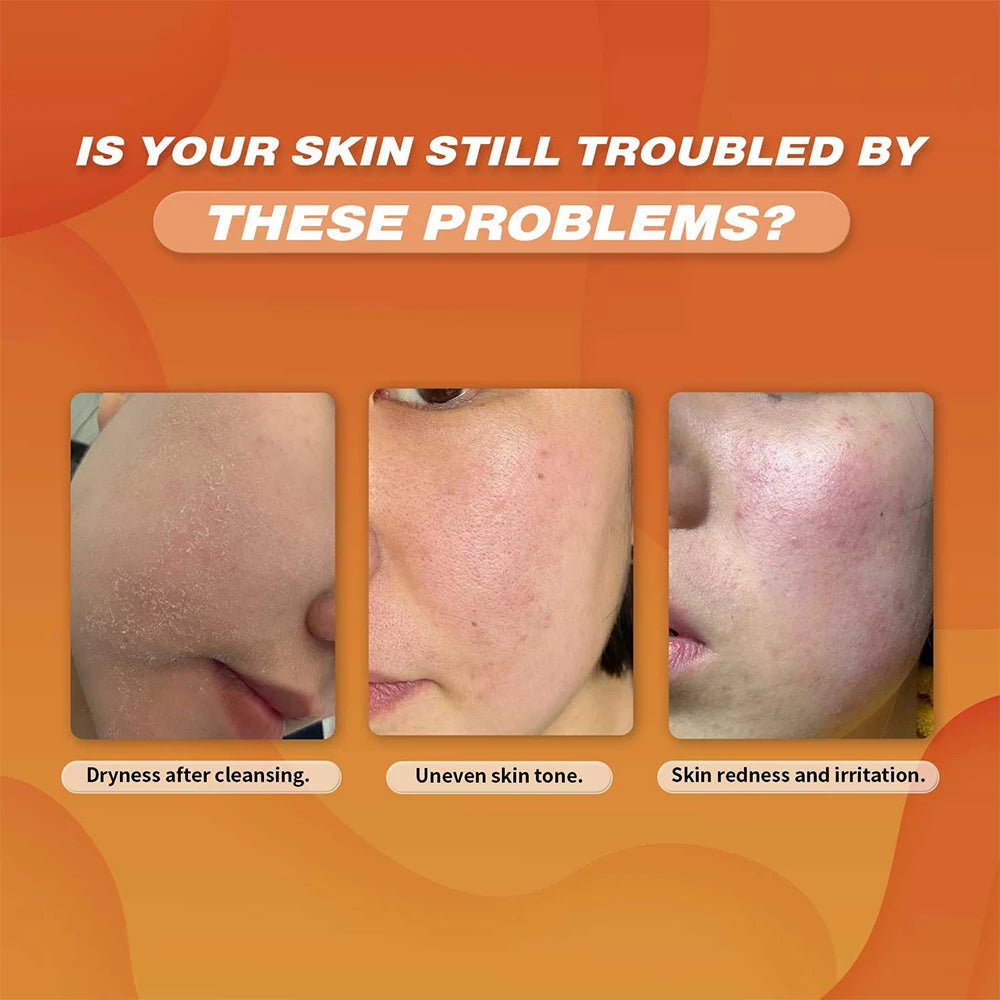 Turmeric Face Cleanser 40pcs Turmeric Kojic Acid Facial Exfoliating Cleansing Pads Reduce Dark Spots Skin Brightening Face Wash