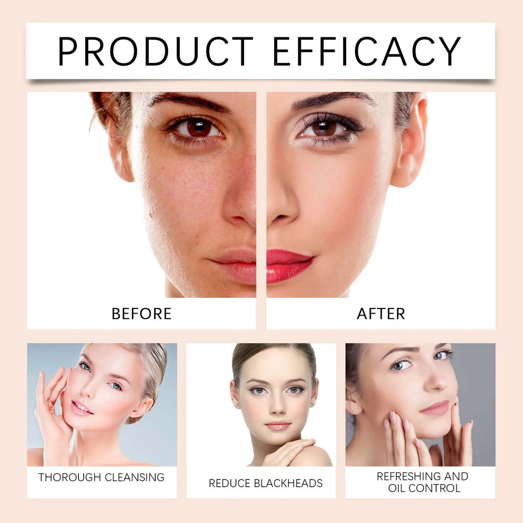 Turmeric Foam Cleanser Brightening Facial Wash Oil Control Hydrating Non Drying Formula With Brush Head Blackhead Removal 100ml