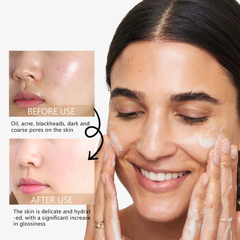 RAVE LADY Low PH 150ml Facial Cleanser Gentle Oil Control Moisturizing Face Wash Whitening Facial Foam Exfoliating Deep Remove